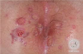 images?q=tbn:ANd9GcTbg_Txyy-mplmlUsNG_givOcbwtzDYjAwKCHaDUrrXZd52YMCG