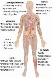 Image result for Scleroderma polyrhizon