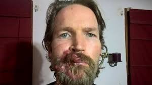 Fundraiser by Sherrie Lilly Morici Buckmeier : PATRICK BUCKMEIER TRIP HOME