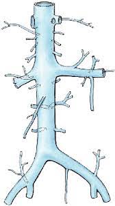 Inferior Vena Cava Syndrome Wikipedia