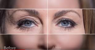 Naara Collagen Skin Care Collagen Supplement Jeunesse Global After reviewing the patient's medical history during the initial consult to see if there are any factors that could lead to complications. naara collagen skin care collagen
