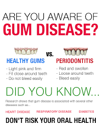 Signs Of Gum Disease Include Red Swollen Or Tender Gums Bleeding Gums While Brushing Or Flossing Gums That Seem To Gum Disease Bad Breath Periodontitis