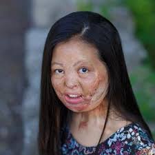 Felicia Berling's fundraising page for Shriners Hospitals for Children