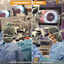 Ileri Yaslarda Katarakt Riskini Artirmamak Icin Ultraviyole Filtreli Gunes Gozlugu Kullanmayi Ihmal Etmeyin Cataract Phaco Gozler Gunes Gozlugu Yastiklar