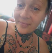 Living with myositis as a lifestyle