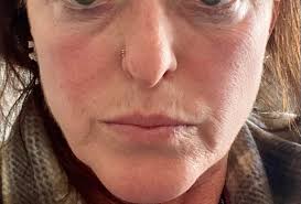 Why does my hosta look like this