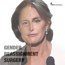 Pin On Sex Reassignment