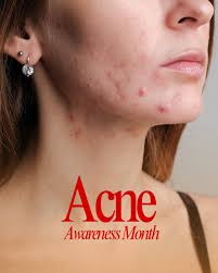 Sutton Dermatology + Aesthetics