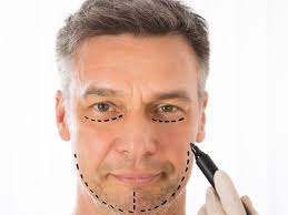 عمليات التجميل للرجال | خاص للرجال - تركيا ،اسطنبول