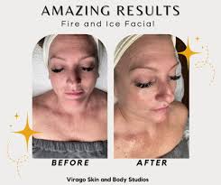 V Skin Care Line (@vskincareline) · North Highlands, CA