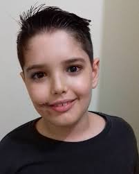 Nathan Benites Vencedor