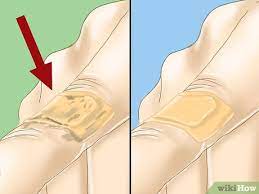 How To Treat A Paper Cut (With Pictures) - Wikihow