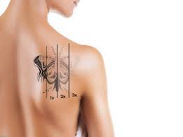 Pigment dermagraphics and laser removal is a custom tattoo studio, and laser tattoo removal. Unbranded Austin Tattoo Removal