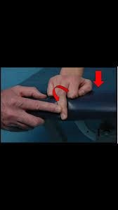 Image result for Elson Extensor Tendon Test