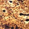 Bone cross section histology : Https Encrypted Tbn0 Gstatic Com Images Q Tbn And9gcrbghdrhr1auzljsiva Kvgjy2o9edr Rjl By0oezg99pk Yc Usqp Cau