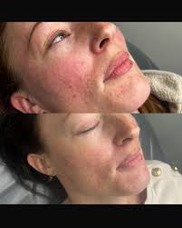 Elysium Beauty Clinic