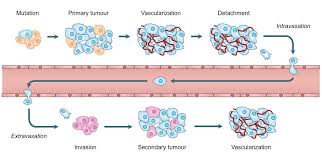 A primary tumour is where the cancer starts. Cancer Development Bioninja