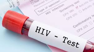 Human immunodeficiency virus atau hiv adalah virus yang menyerang kekebalan tubuh manusia. Penyakit Hiv Gejala Penyebab Pengobatan Klikdokter Com