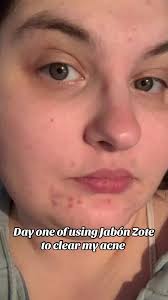 ##skincare #jabonzote #mexicantiktok