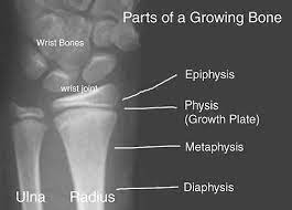 The Growth Plate - Connecticut Orthopaedics