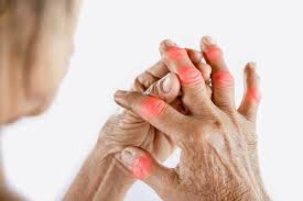 Image result for Hand Injection