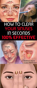 Clear Your Sinuses Sinusitis Sinus Remedies Sinus Drainage