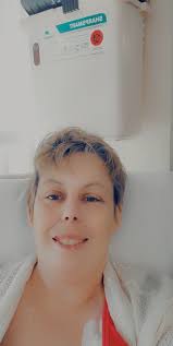 Radiation treatment side effects and timeline