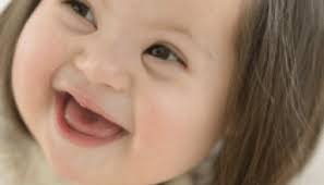 Global Down Syndrome Foundation, the National Down Syndrome Congress, and  the National Down Syndrome Society Highlight the FDA's Public Warning About  Risks Associated with Non-Invasive Prenatal Screening Tests