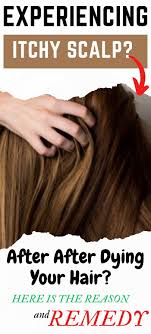 Itchy Scalp Remedies After Applying Hair Dye In 2020 Scalp Itch Itchy Scalp Dyed Hair