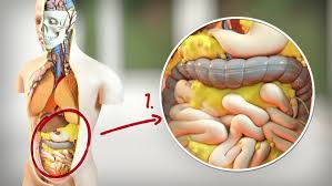 Es ist auch ein zusammenhang erkennbar zwischen adipositas und der entstehung bestimmter tumorerkrankungen. Adipositas Krankhaftes Ubergewicht Erkennen Und Behandeln Ndr De Ratgeber Gesundheit