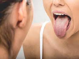 Look at the back of your throat. Tongue Cancer Symptoms Pictures Prognosis