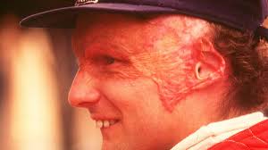 Check spelling or type a new query. History Niki Lauda Injured In F1 Crash At The Nurburgring