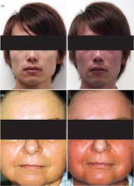 Full article: Clinical and forensic signs related to ethanol abuse: a  mechanistic approach