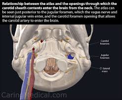 Feb 12, 2004 · the pivot joint in your neck allows you to turn your head from side to side. How Neck Pain And Cervical Spine Instability Cause Nausea Gastroparesis And Other Digestive Problems Caring Medical Florida