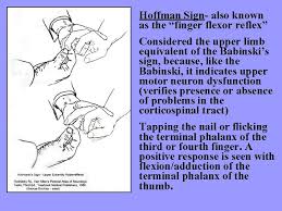 Hoffmann's reflex may be seen in the following conditions: Pyramidal Voluntary Motor System Dr G R Leichnetz