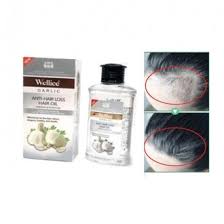 Here's how to do it: Buy Now Wellice Garlic Anti Hair Loss Hair Oil Only In Rs 980