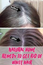 Home Remedy To Get Rid Of White Hair Ladies Grace Grey Hair Remedies Hair Remedies White Hair Beauty