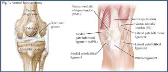 When the tendon is placed under pressure it can not handle small tears may form. Traumatic Patellar Dislocation Hughston Clinic