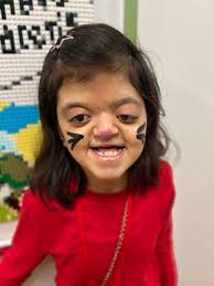 Kari Tucker, associate director of philanthropy, talked to Good Day Dayton  about the inspiration behind our custom Shriners heart ornament. We  couldn't provide the specialized care to children with burns and  craniofacial