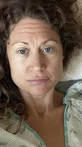 Amanda started to feel a fullness in her pelvis. A CT scan soon revealed a  grapefruit-sized mass in her pelvis. The official diagnosis was  extraovarian primary peritoneal carcinoma, an incredibly rare ...