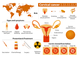 Your medical team will recommend treatment based on these factors as well as slowing the spread of cancer, palliative treatment can relieve any pain and help manage other symptoms. Recent Study Shows That Cervical Cancer Has A Higher Death Rate Than Experts Previously Thought