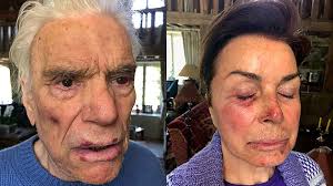 Find the perfect bernard tapie stock photos and editorial news pictures from getty images. Agression De Bernard Tapie Et Sa Femme La Famille Accepte De Diffuser Des Photos Choc Du Couple