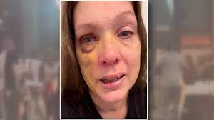 Holly, a victim of the downtown Cincinnati brawl, has spoken on camera for  the first time since the incident: https://bit.ly/46Ghquy More than  $180,000 has already been raised to help with her recovery.