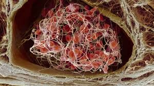 Para que esto suceda, debe heredar el. Terapia Genica Un Tratamiento Para La Hemofilia