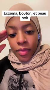 #Eczéma #psiorasis #PlotNoir #PeauBlanche  #Dermatologue#fyp#foryou#pourtoi#diceytalk