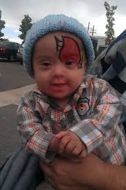 How To Deliver A Diagnosis Of Down Syndrome: An Open Letter To OB/GYNs