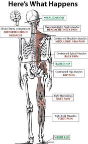 Pin On Shoulder Neck And Back Pain Relief