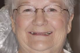 Porcelain crowns and teeth bonding