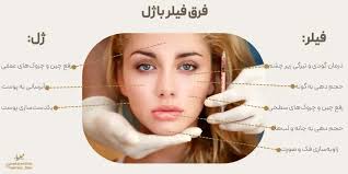 فرق فیلر با ژل چیست؟| 6 تفاوت فیلر با ژل که باید بدانید!‌