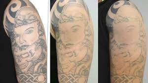 If you are looking for methods to remove a tattoo at home then go for hydrogen peroxide. Hydrogen Peroxide To Fade A Tattoo Youtube